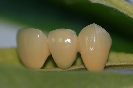 이전 톱니를 위한 치아 설계 연구실 가득 찬 요업 ISO13485 산화 지르코늄 치아관