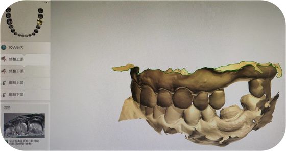 구술 스캐닝한 STL 파일의 CAD 지 상압흔