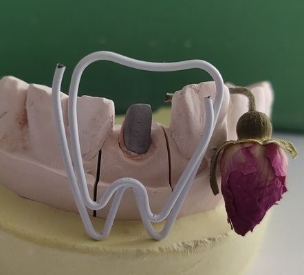 금속 치아의 포스트와 endodontic 처리 뒤에 있는 핵심