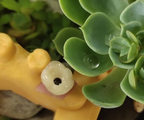 큰 생물학적 적합성 ANKYLOS 치과용 임플란트 지원받는 크라운