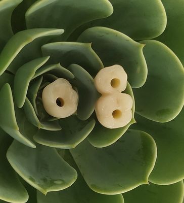 골내 치과용 임플란트 크라운