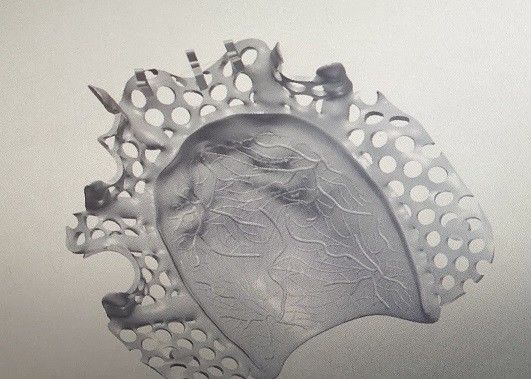 CAD 디자인 티탄 합금 국소 의치 금속 뼈대