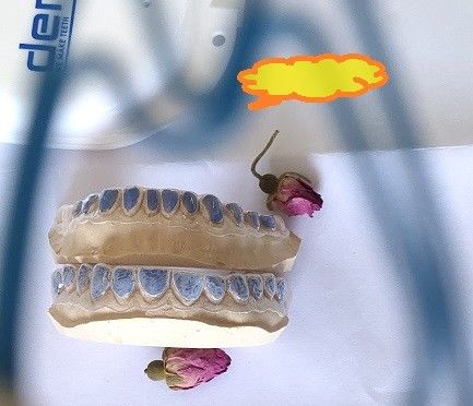 미백 치아를 위한 맞춘 ISO13485 표백성 트레이