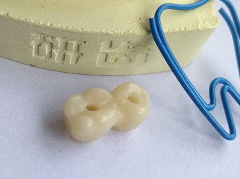 CAD 캠 설계 치아 3D 인쇄