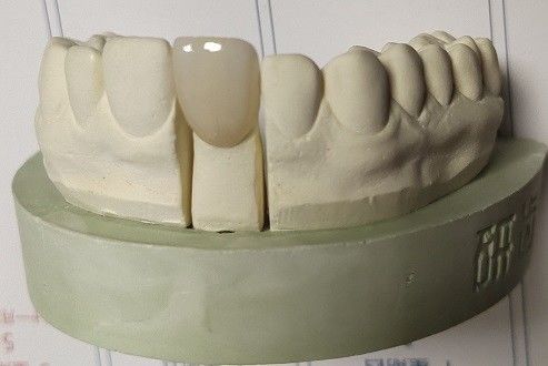 CAD 캠 분쇄에 의한 산화 지르코늄 블록 치아 3D 인쇄
