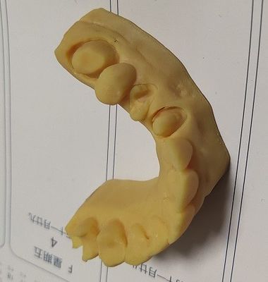 고 정밀도 ISO13485 트루시인 치음 인쇄 모델 3D명