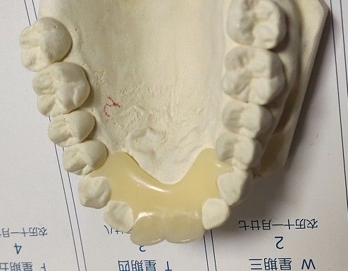 부드러운 탄력 있는 나일론 트루시인 보이지 않는 틀니