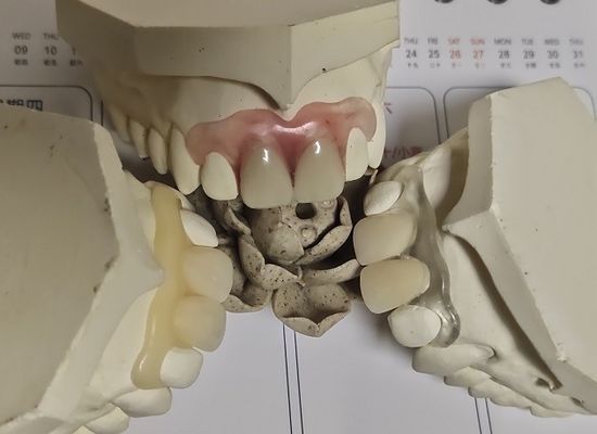 편안한 핏트 ISO13485 RPD 부드러운 보이지 않는 틀니