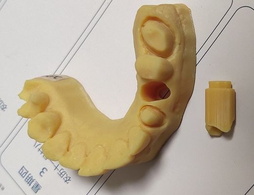고 정밀도 ISO13485 트루시인 치음 인쇄 모델 3D명