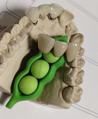 CAD 캠 설계 치아 3D 인쇄