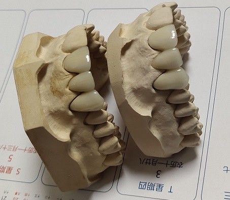 자기 CAD 캠 PFM 크라운