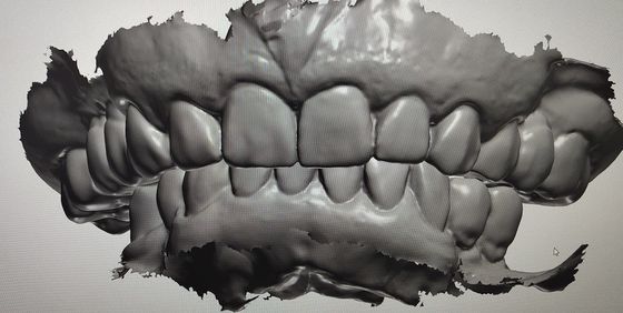 CAD 캠 설계 디지털 표시 모형 치아 다른 치과용 제품